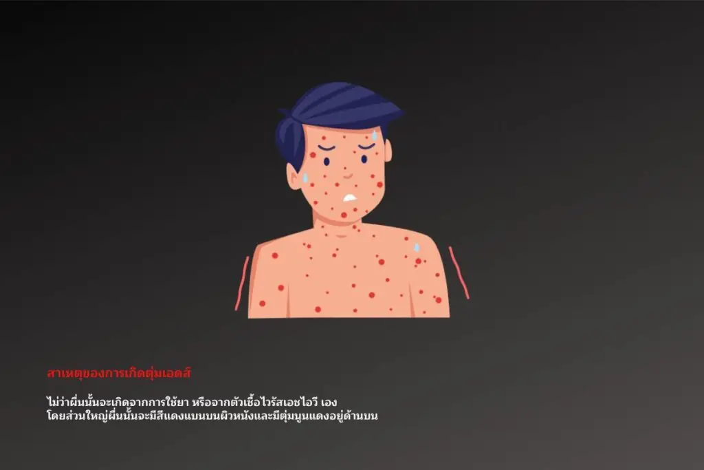 สาเหตุของการเกิดตุ่มเอดส์