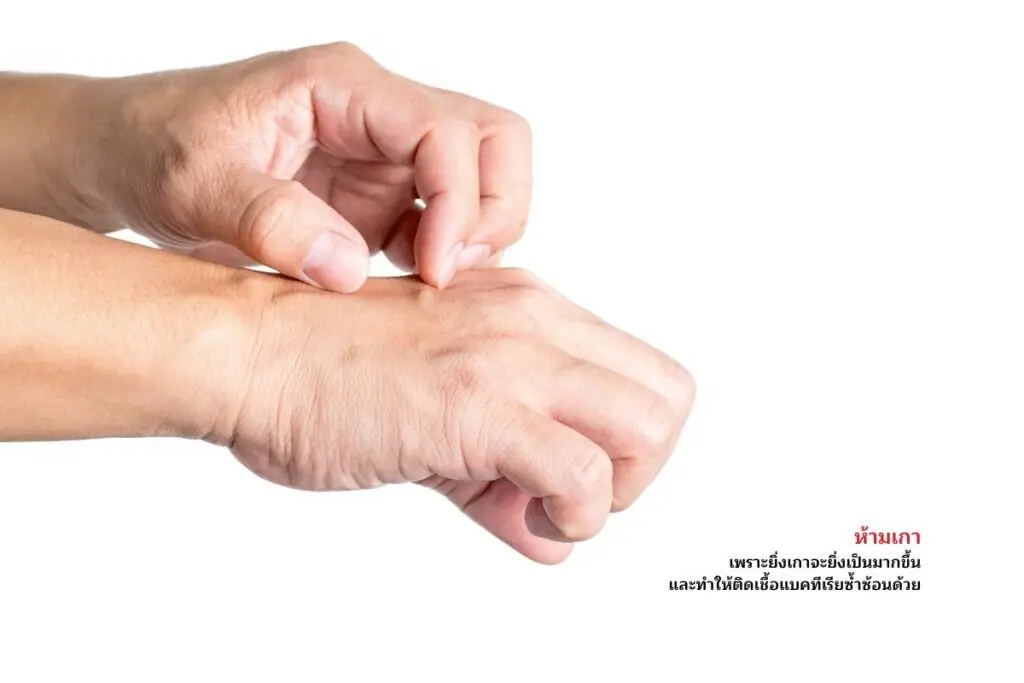 ห้ามเกา
