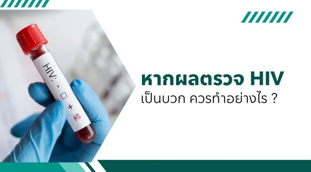 หากผลตรวจ HIV เป็นบวก ควรทำอย่างไร
