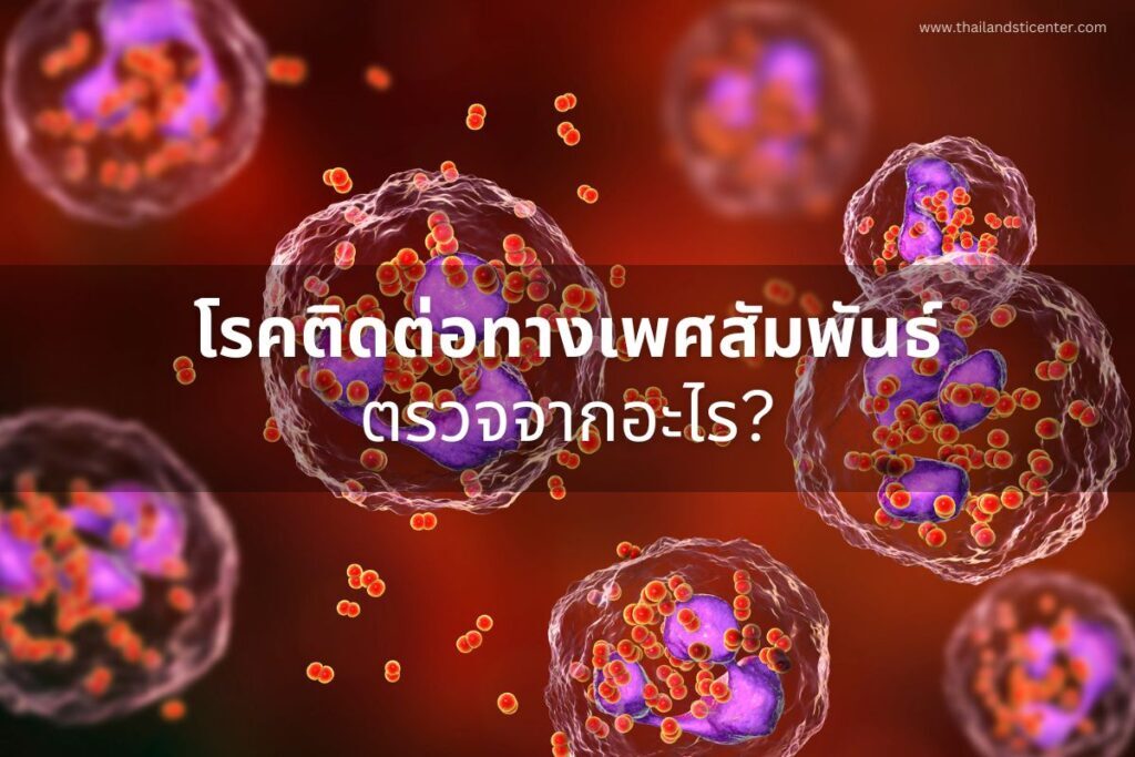 โรคติดต่อทางเพศสัมพันธ์ ตรวจจากอะไร