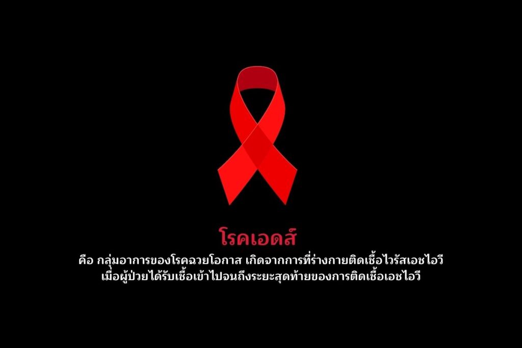 โรคเอดส์