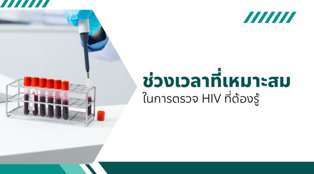 ช่วงเวลาที่เหมาะสมในการตรวจ HIV ที่ต้องรู้